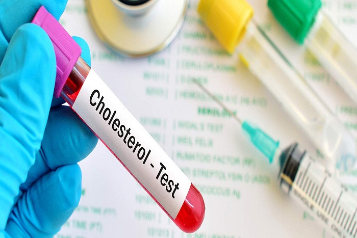 Obat Kolesterol Jahat Alami Yang di Percaya Masyarakat Secara Turun Temurun
