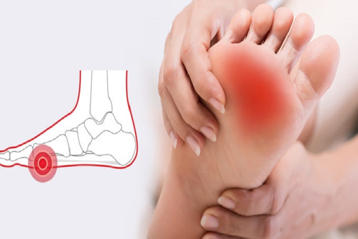 Yuk Kenali Penyebab Telapak Kaki Sakit