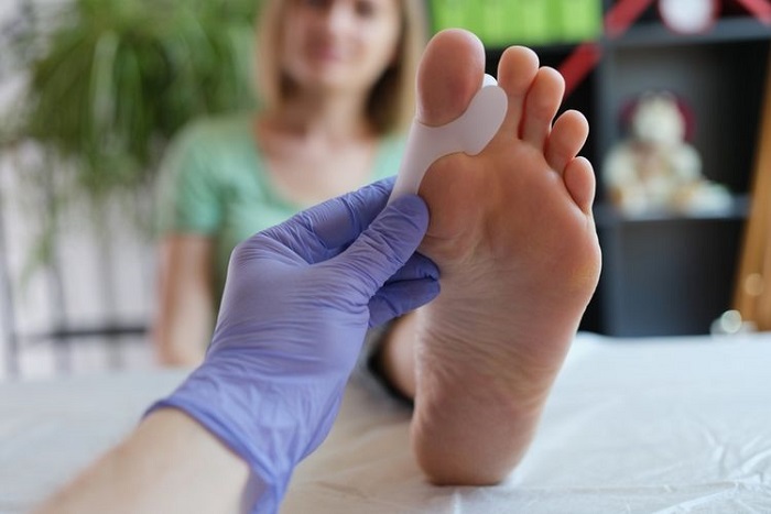 Tips Menurunkan Kadar Asam Urat dalam Tubuh secara Alami
